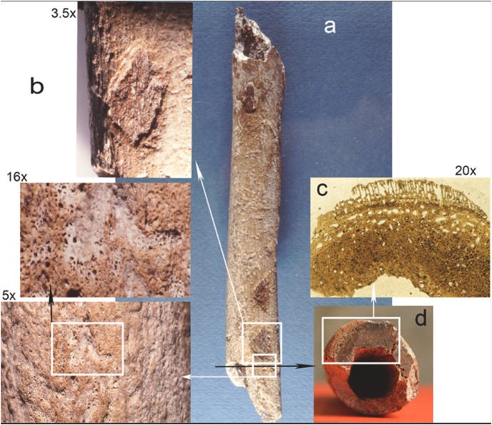 Pathological examination of the femur