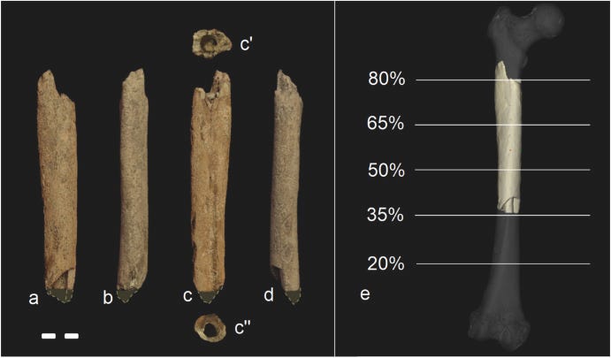 Anatomical comparison of the femur