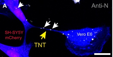 Visual representation of COVID particles moving between cells