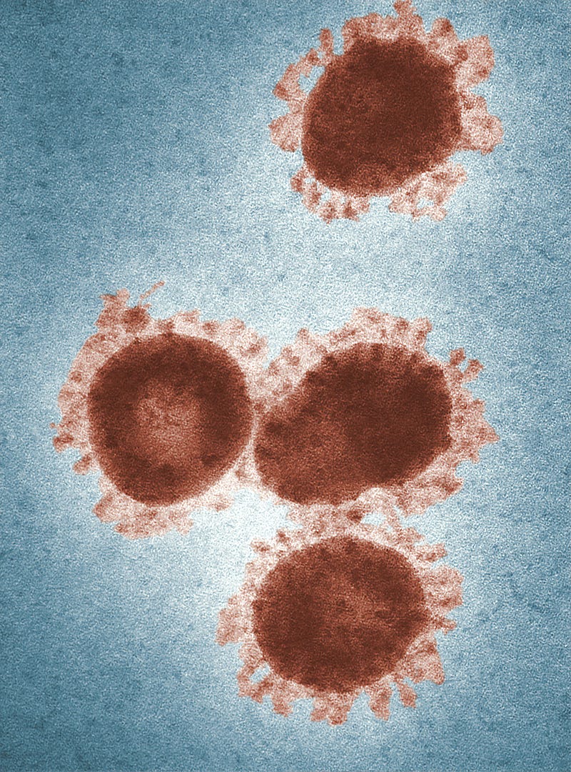 Electron microscopy image of viruses