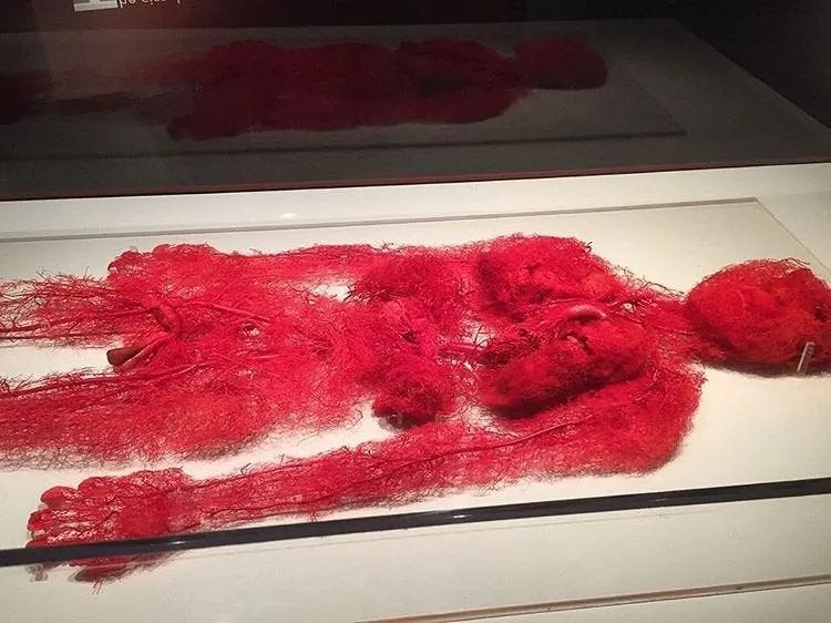 Actual human vascular system